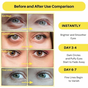 Collagen Under Eye Patches - Anti-Aging, Dark Circle & Puffy Eye Treatment - Hydrates and Firms Skin - 30 Pairs