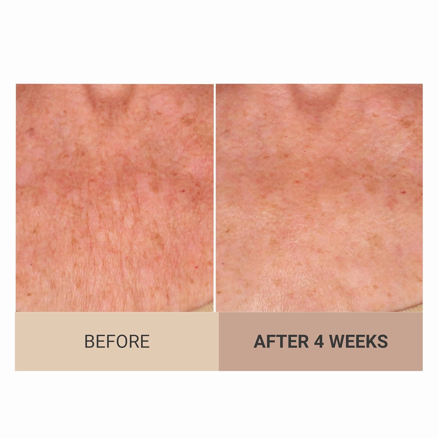 Consult Beaute Champagne Lift Hydrating Firming Body Cream with Pink Pepperslim for Crepey Skin Moisturizer Tightens, Tones & Hydrates Dry Skin on Arms & Legs - Vanilla Absolute, 8 oz.