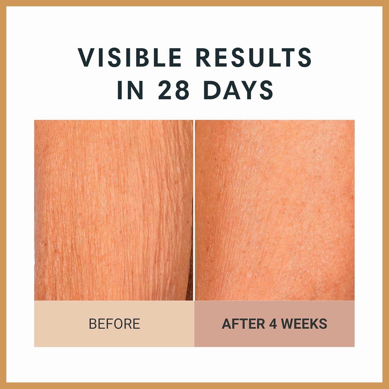 Consult Beaute Champagne Lift Hydrating Firming Body Cream with Pink Pepperslim for Crepey Skin Moisturizer Tightens, Tones & Hydrates Dry Skin on Arms & Legs - Vanilla Absolute, 8 oz.
