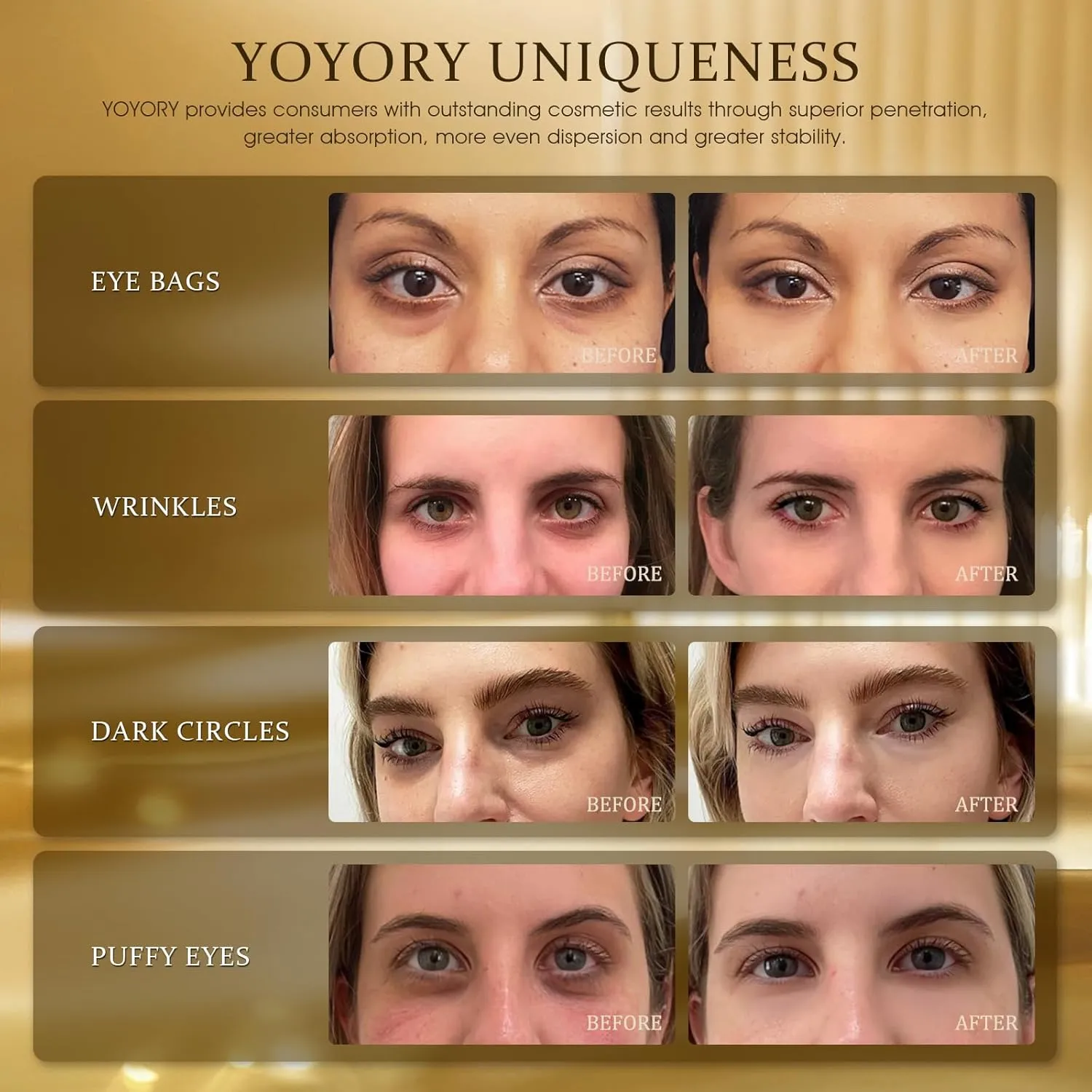 Hydrogel Eye Patches for Dark Circles, Puffy Eyes & Wrinkles - Collagen & Hyaluronic Acid Infused Under Eye Masks, Hydrating Firming Care, Fine Lines,Eye Bags Reduction (60 Pcs) Gold