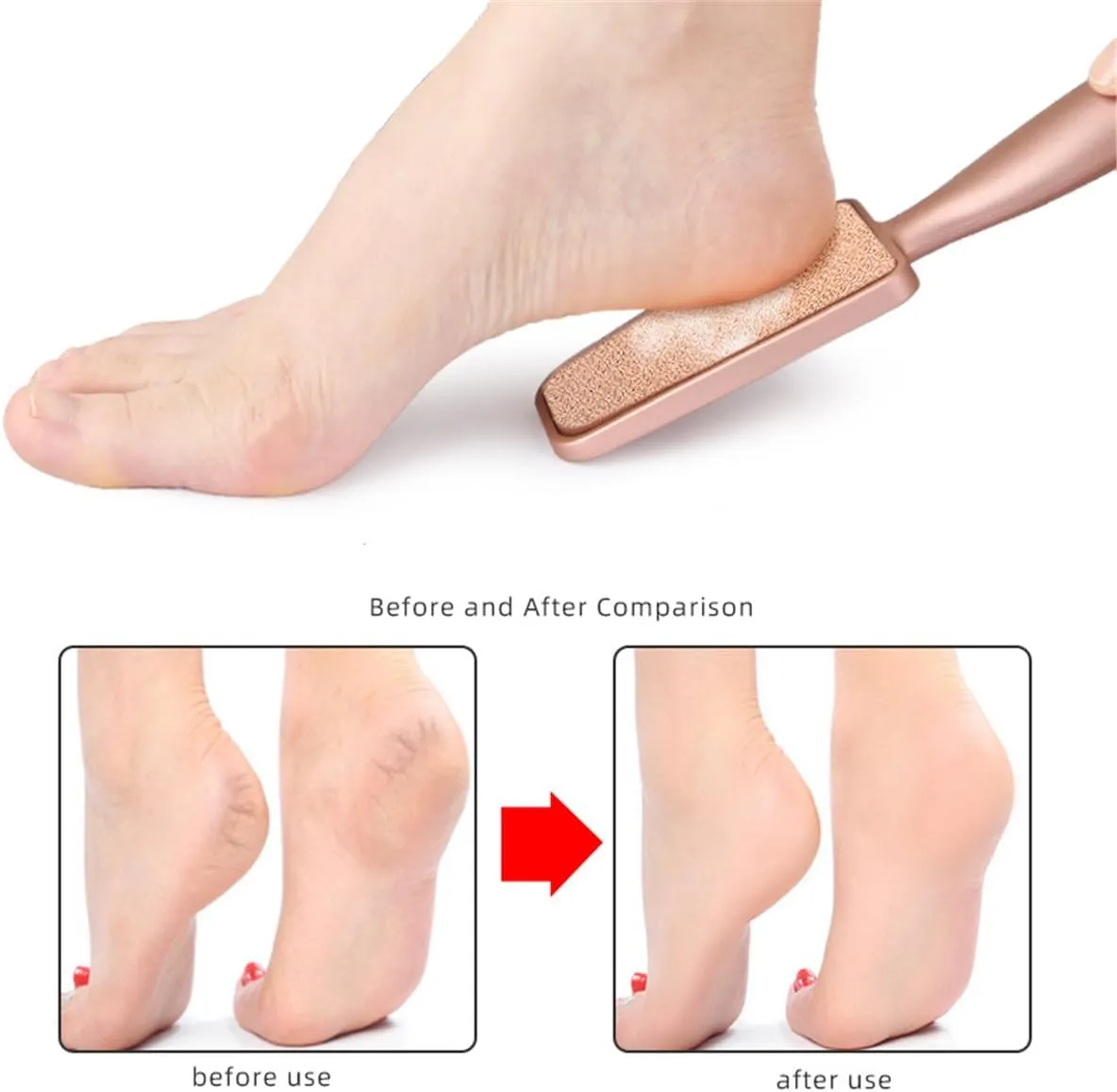 Nano Glass Foot File Callus Remover, oot Scrubber and Heel Scraper for Dead Skin Removal, Foot Buffer Pedicure Tool, Perfect for Men and Women, Get Soft, Smooth Foot (Rose-Gold)